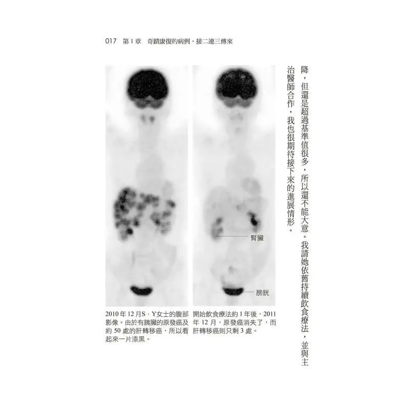 Miracle AntiCancer Diet Eight Principles To Inhibit Cancer Cells And Enhance Immunity Even Advanced Cancer Patients Can Recover