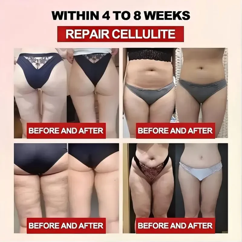 Fat Burning Weight Loss Summer Slimming Kit Lose Weight Fast Burn Fat Belly Slimming Oil with Detox Body Care Tool