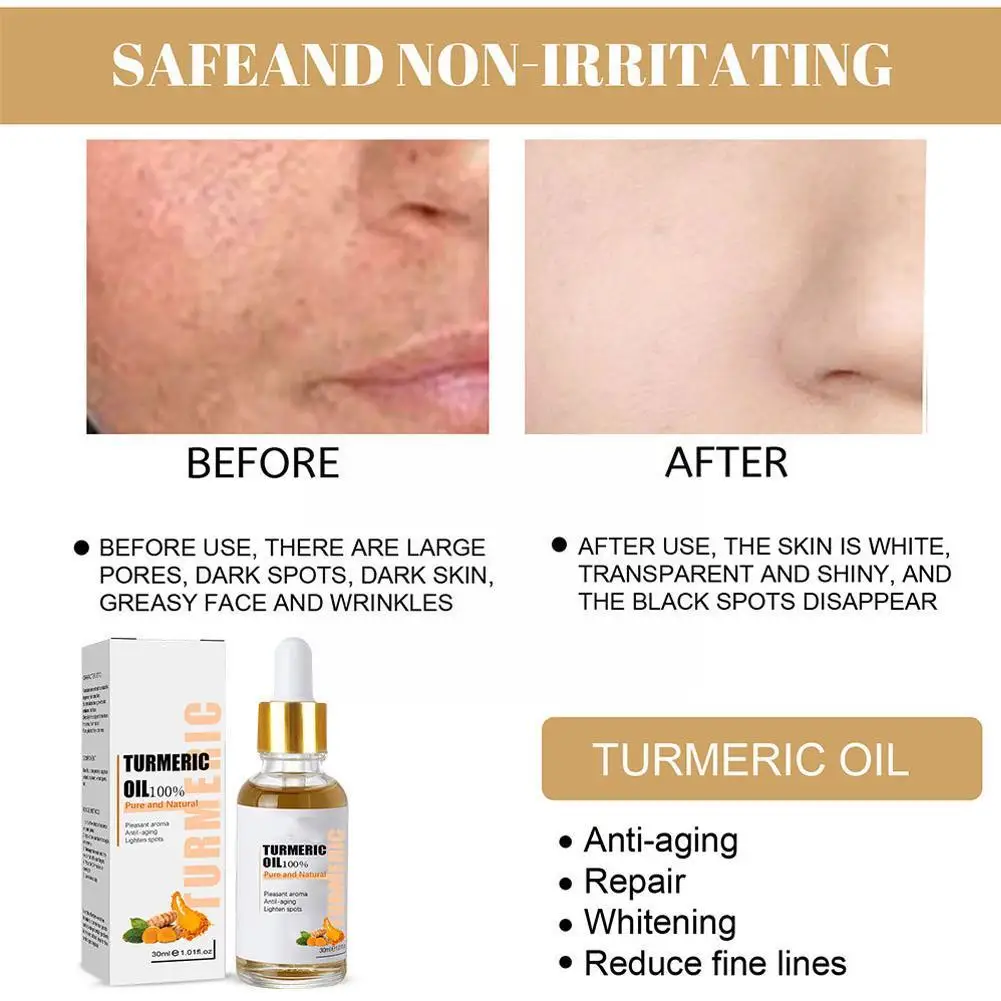 NEW Turmeric Freckle Whitening Serum Fade Dark Spot Beauty Removal Correcting Skin Facial Pigment Essence Care Face Y7H3