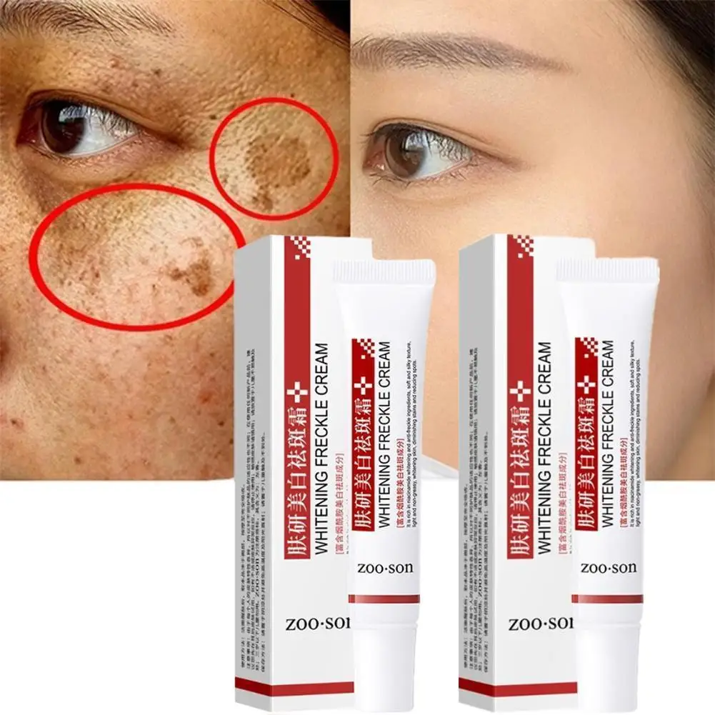 2Pcs Effective Whiten Freckle Cream Brighten Face Remove Dark Face Spot Melasma Anti-pigmentation Improve Dullness Skin Care Cre