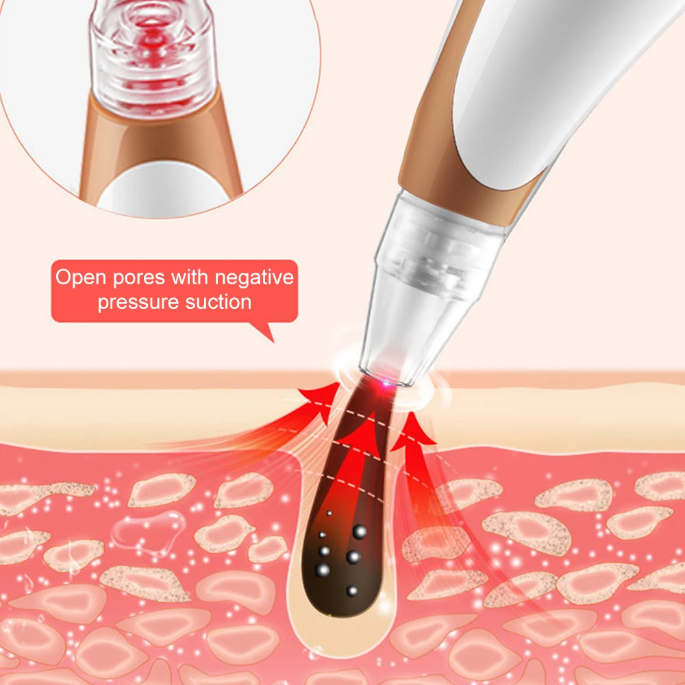 전기 블랙헤드 제거제 및 모공 클리너, 딥 클렌징을 위한 피부 강화 기능이 있는 여드름 치료 페이셜 장치 스킨케어 도구