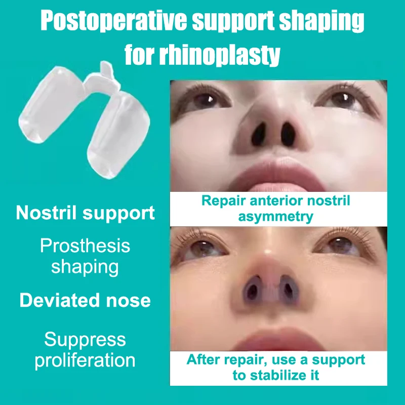 1Pc Postoperative Rhinoplasty Nostril Support Silicone Shaping Crooked Nose Correction Fixator Silica Gel Nose Clip...