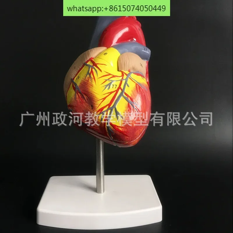 Anatomical model of natural large heart Medical heart model of Department of Ultrasound Cardiology Cardiac teaching model