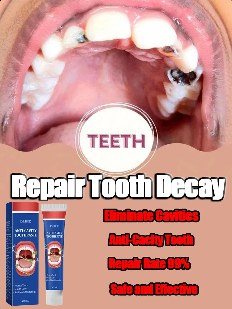 14N Advanced Dental Care: Teeth whitening anti, Anti-Cavity,Fresh Breath, Plaque Removal, Toothache Relief, Periodontitis Repair
