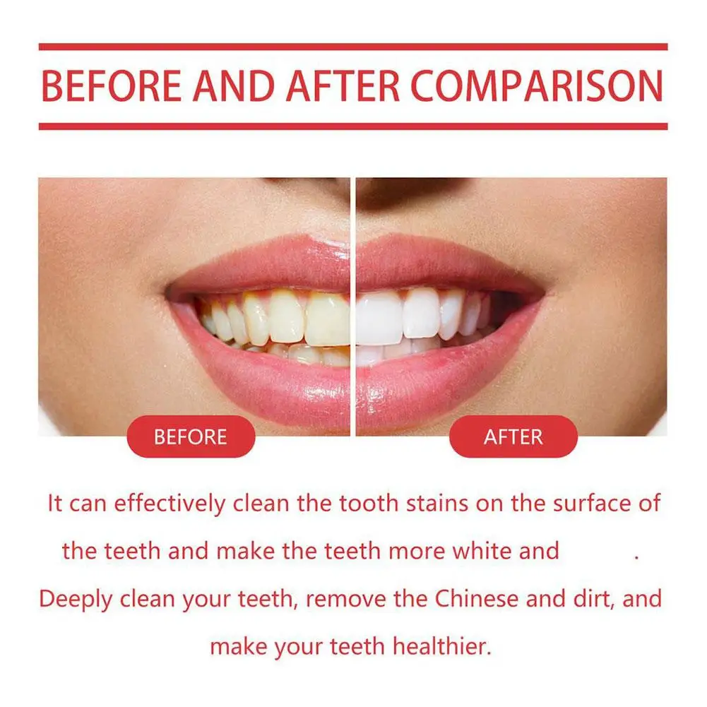 SP-6 Probiotic Toothpaste Brightening Stain Removing Sp-6 Probiotic Toothpaste Fresh Breath Teeth Whiten Toothpaste