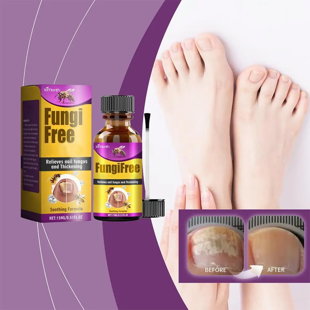 Bee Nail Care Solution Foot Toe Nail Fungus Removal Serum Repair Onychomycosi Anti Infection Care Products