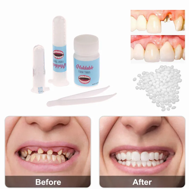 Temporary Filling Teeth Glue False Filling Cavity Broken Teeth Teeth Gap Filling Solid Glue Particles Can Be Shaped Teeth Glue