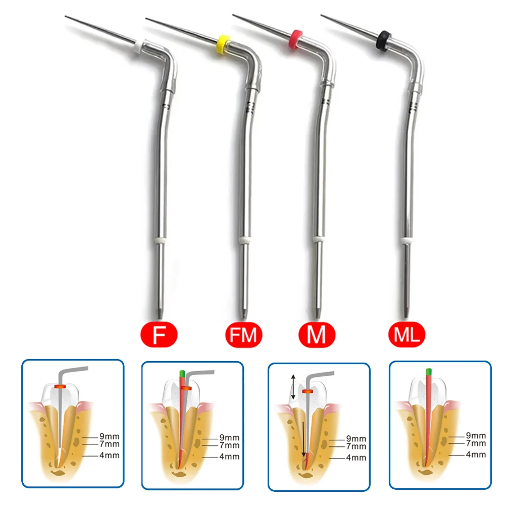 4 шт. стоматологические аксессуары, стоматологическая ручка Gutta Percha, насадки с подогревом, система обтурации F Fm M Ml, насадки для корневых каналов, стоматологические насадки с подогревом, инструмент