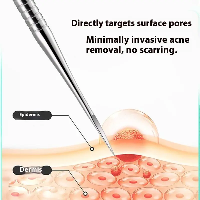 {MX} boutons Ultra-fins points noirs pince à points blancs en acier inoxydable particules de graisse d'acné enlever l'aiguille outils de nettoyage de beauté du visage