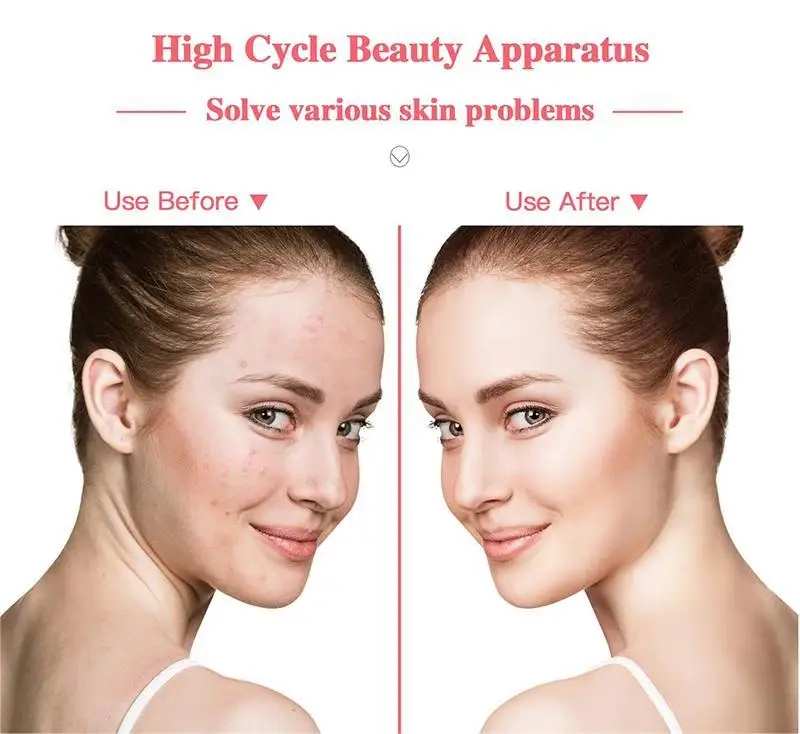 Profesjonalna maska ​​terapeutyczna LED 4 w 1 i urządzenie do twarzy z światłem argonowym - leczenie trądziku, przeciwstarzeniowe, odmładzające maszyna kosmetyczna