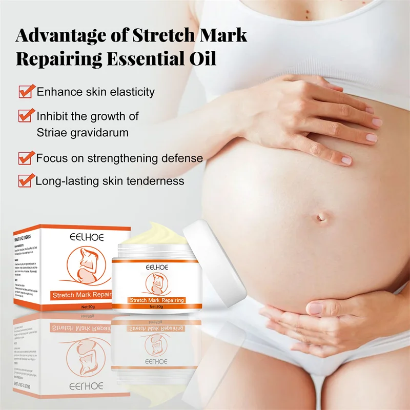 Stretch Mark Vanishing Cream Repair Anti-Wrinkle Anti-Aging Pregnant Women Stretch Marks Treatment Cream Vitamin E Skin Care 50g