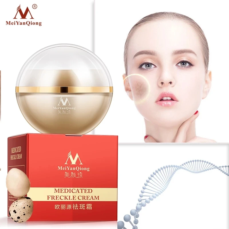 30G Anti Freckle Cream Whitening Fade Cream Lightening Blemish Removal Serum Reduces Age Spots Freckles Melasma Face Cream
