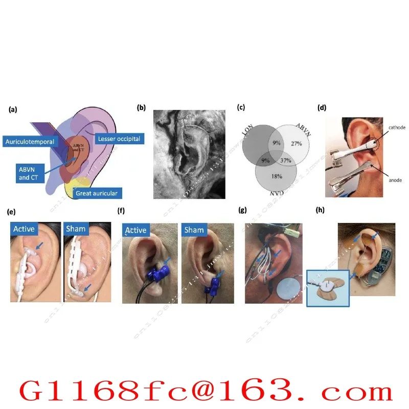 TENS Ear Massager Vagus Nerve Stimulation Device Home Physical Therapy Equipment Relaxation Relief