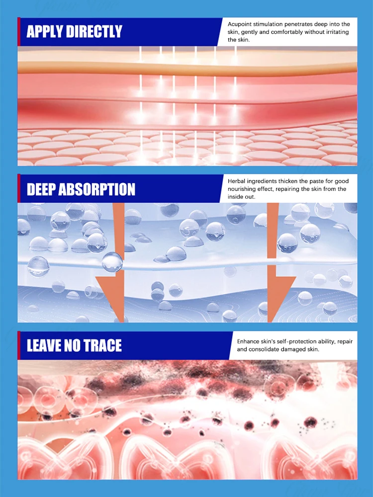 ᴴᵉʳʳᵃᵐⁱᵉⁿᵗᵃ ᵈᵉ ᵗʳᵃᵗᵃᵐⁱᵉⁿᵗᵒ ᵈᵉ ˡᵘᶻ ᵃᶻᵘˡ ᵐᵃ́ˢ ᵛᵉⁿᵈⁱᵈᵃ ᵖᵃʳᵃ ᵘⁿᵃ ʳᵃ́ᵖⁱᵈᵃ ʳᵉᵖᵃʳᵃᶜⁱᵒ́ⁿ ᵈᵉ ˡᵃ ᵖⁱᵉˡ ᑫᵘᵉ ʳᵉᵃˡᵐᵉⁿᵗᵉ ᶠᵘⁿᶜⁱᵒⁿᵃ‧