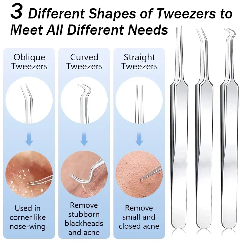 여드름 트위저 블랙 헤드 제거 바늘, 모공 클리너, 딥 클렌징 페이셜 스킨 케어 도구, 11 개
