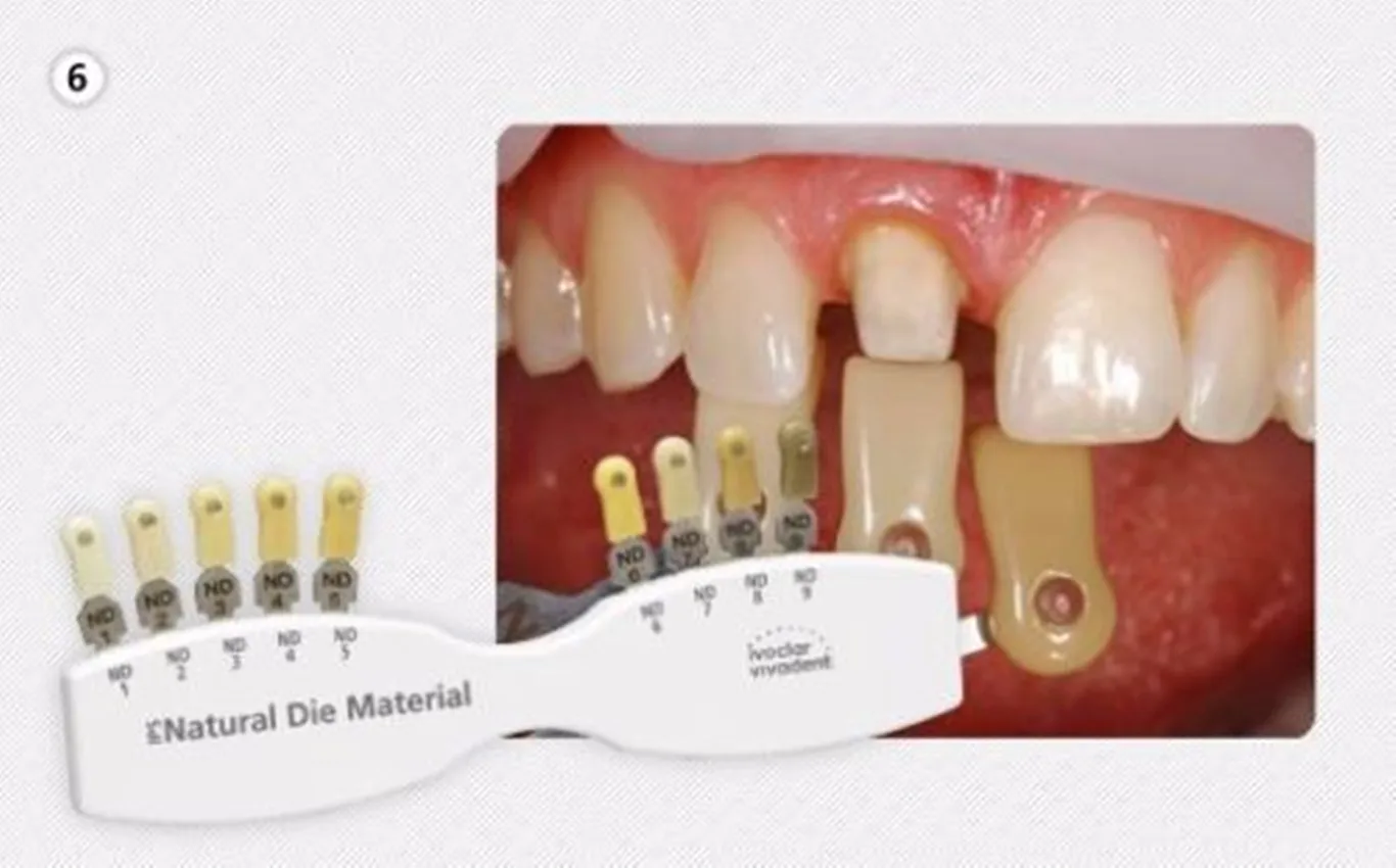 1Pcs Dental Porcelain Teeth Denture Teeh Color Shade Board Guide Vivadent ND1-9 Abutment 20/16Color