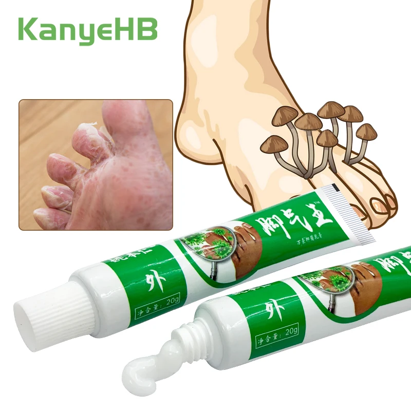 2Pcs Anti-fungal Foot Cream Herbal Athlete Foot Anti Itch Cream Remove Foot Corn Antibacterial Feet Care Beriberi Cream A1066