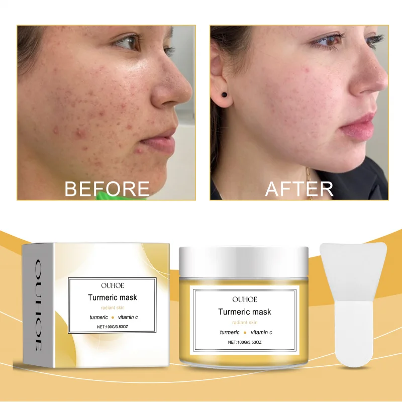 

Turmeric Whitening Mask Turmeric Nourishing Fading Pigment Deep Cleansing Moisturizing Skin Care Facial Mask Skincare Treatment