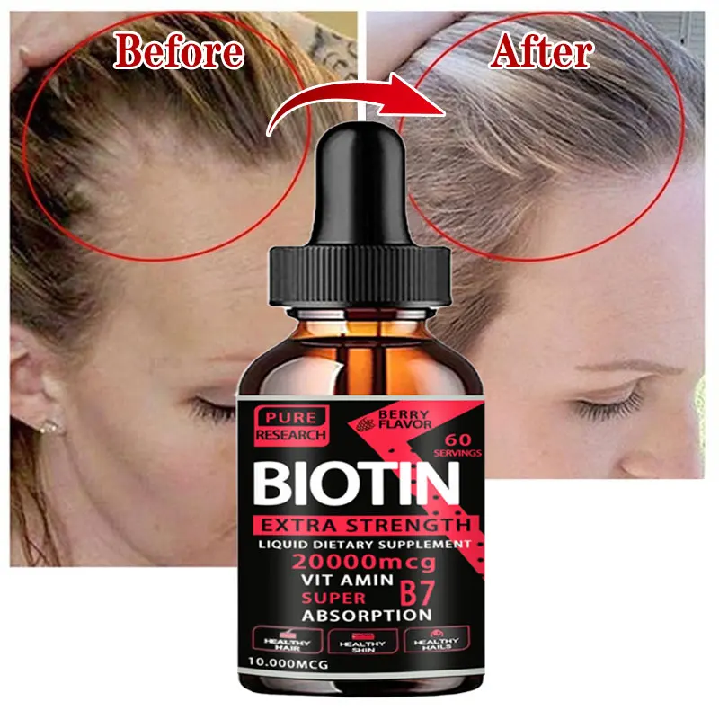 Fast Hair Growth Oil Hair Regeneration Essence Hair Thinning Treatment Hair Growth Fluid Anti-Hair Loss Care for Men and Women