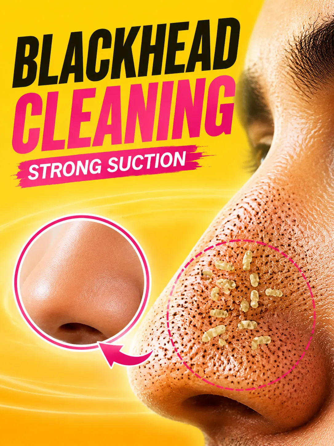Blackhead Remover Facial Vacuum Cleaner Adjustable Suction Pore Cleaning Tool for Personal Beauty Care