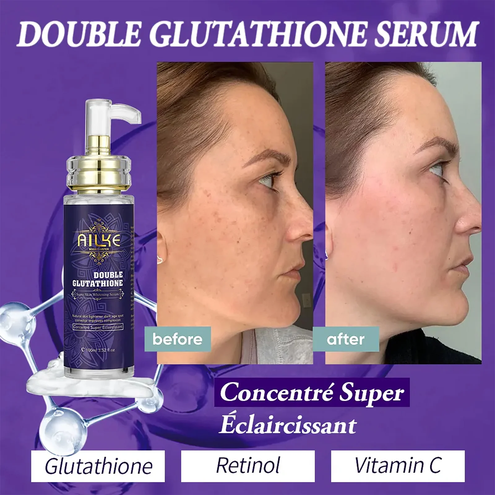 AILKE Double Glutathione Whitening Essence, Moisturizing, Removes Dark Spots, Even Skin Tone Serum For All Skin Types, 100ml - AliExpress 66 AILKE Double Glutathione Whitening Essence, Moisturizing, Removes Dark Spots, Even Skin Tone Serum For All Skin Types, 100ml - AliExpress 66