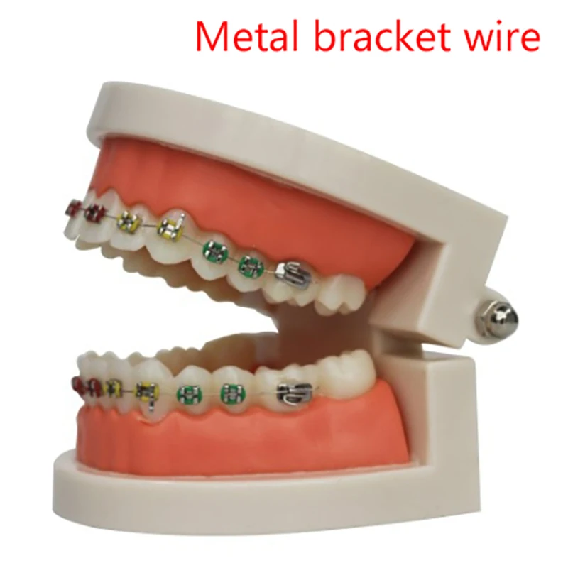 Modelo ortodôntico dentário com suportes, Dentes padrão, Metal ortodôntico, Cinta cerâmica, Ensino de odontologia, Estudo demo