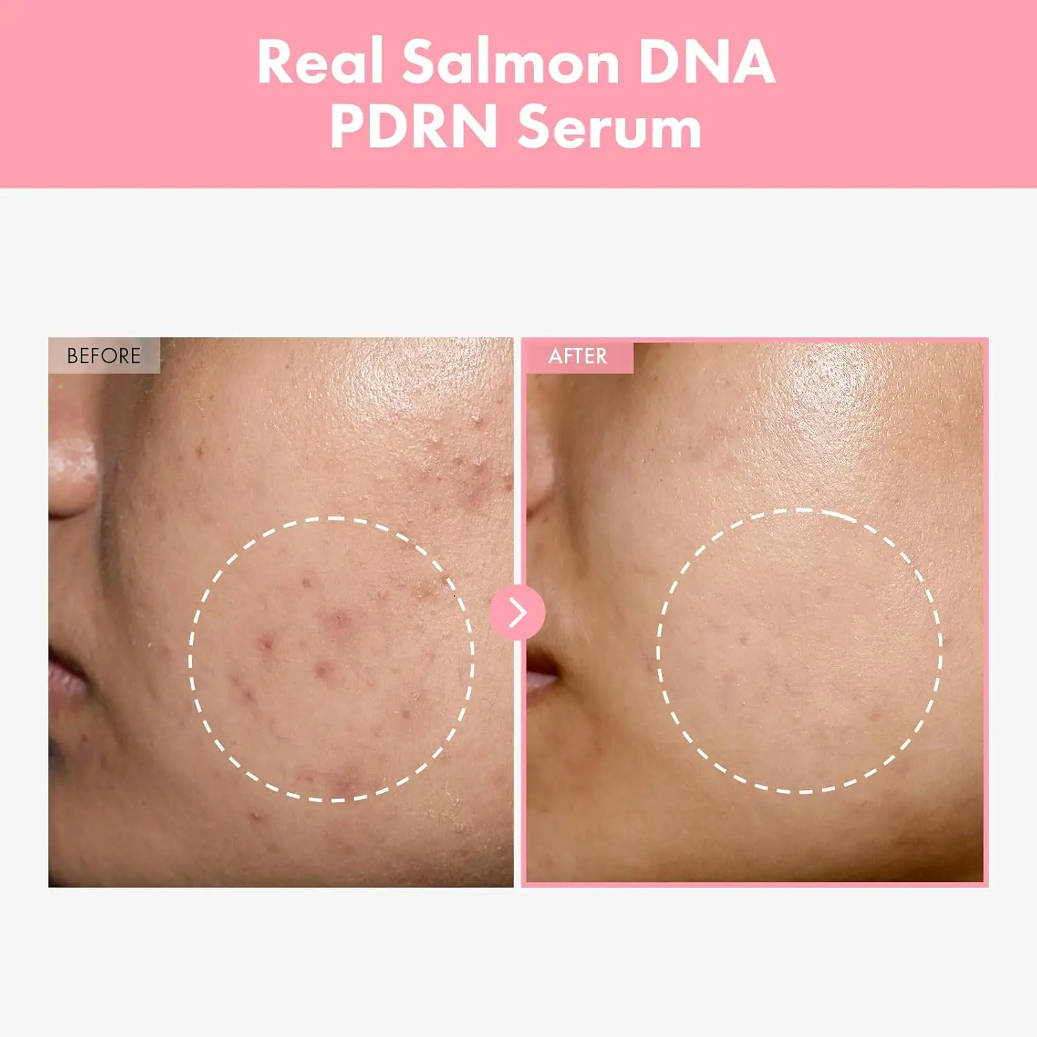 2pcs Pdrn Pink Peptide Serum Targets Dark Spots Strengthens The Skin's Barrier