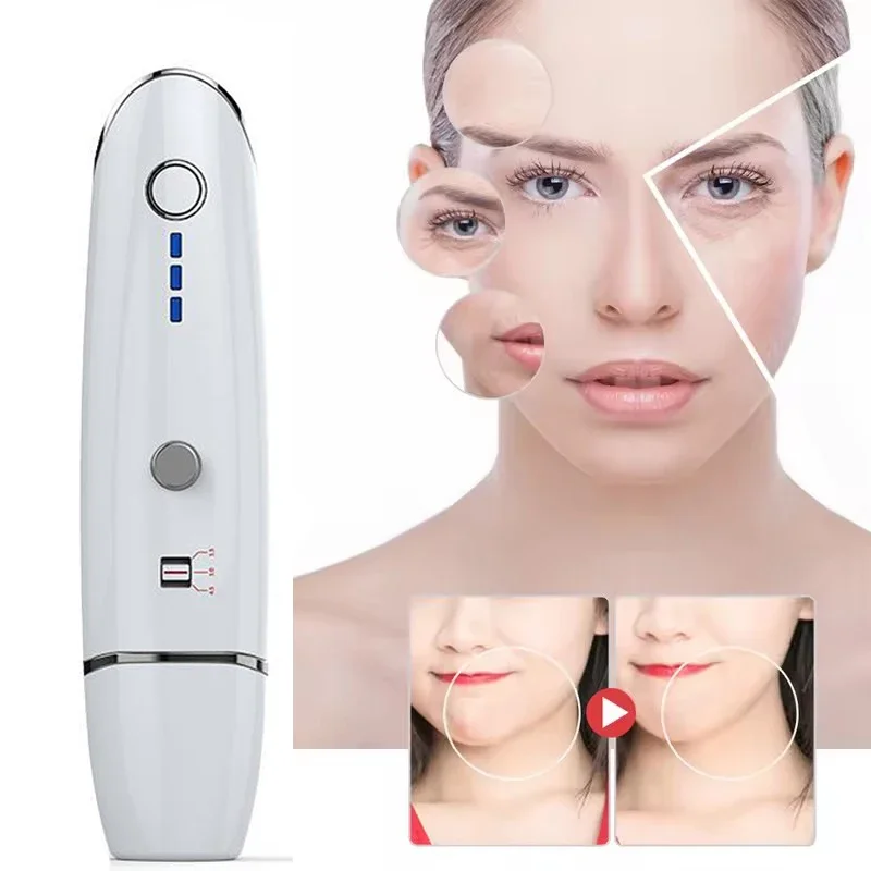 4MHz RF Hifu آلة شد الوجه الذقن المزدوجة إزالة الجبين الرقبة طيات التجاعيد أكياس العين الجلد إحياء الكولاجين تشديد V-الوجه #1
