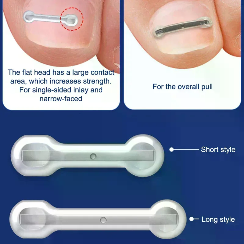 Kit de traitement des ongles incarnés, 12 pièces, avec 4 tailles multiples, outils correcteurs d'ongles incarnés en alliage de titane pour correcteur d'ongles incurvés