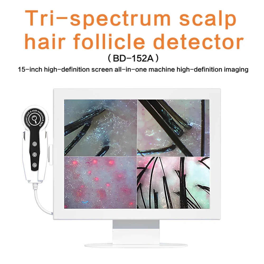 Scalp hair analyzer beauty skin hair scalp tester analyzer professional beauty equipment