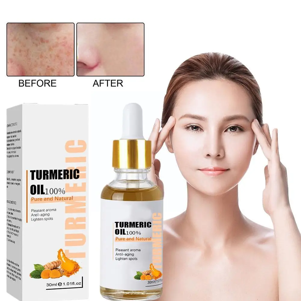 NEW Turmeric Freckle Whitening Serum Fade Dark Spot Beauty Removal Correcting Skin Facial Pigment Essence Care Face Y7H3