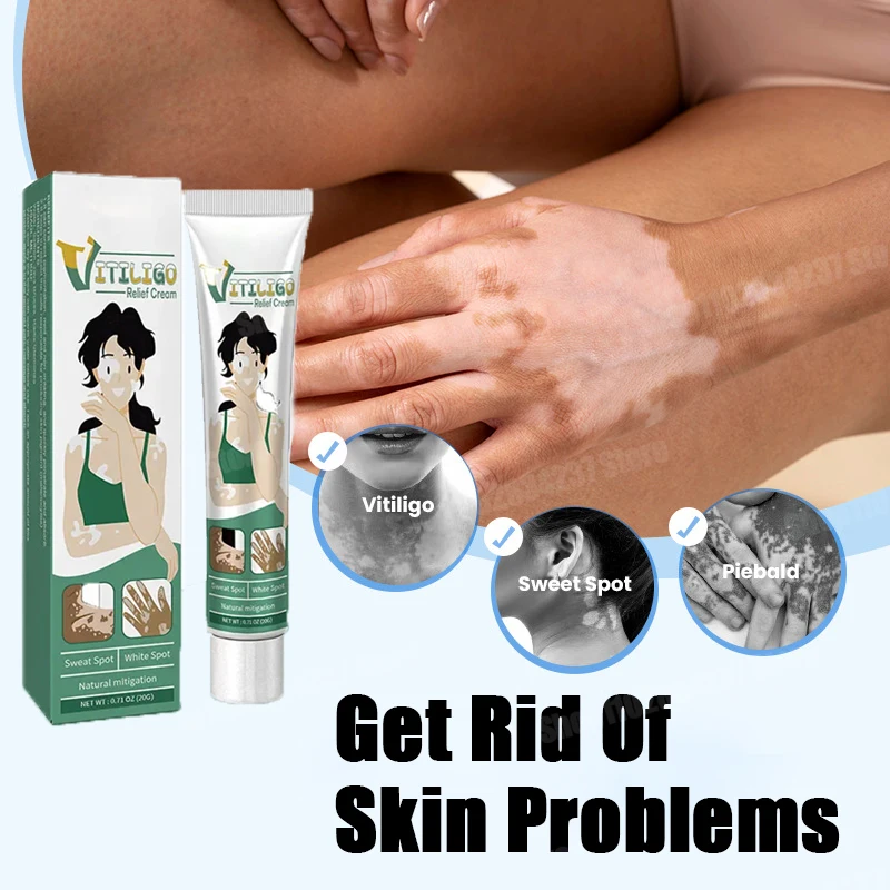 

White Spot Cream for Vitiligo White Spots Leukoplakia Pigmentation Melanin Promoting Vitiligo Cream Skin Care 2024