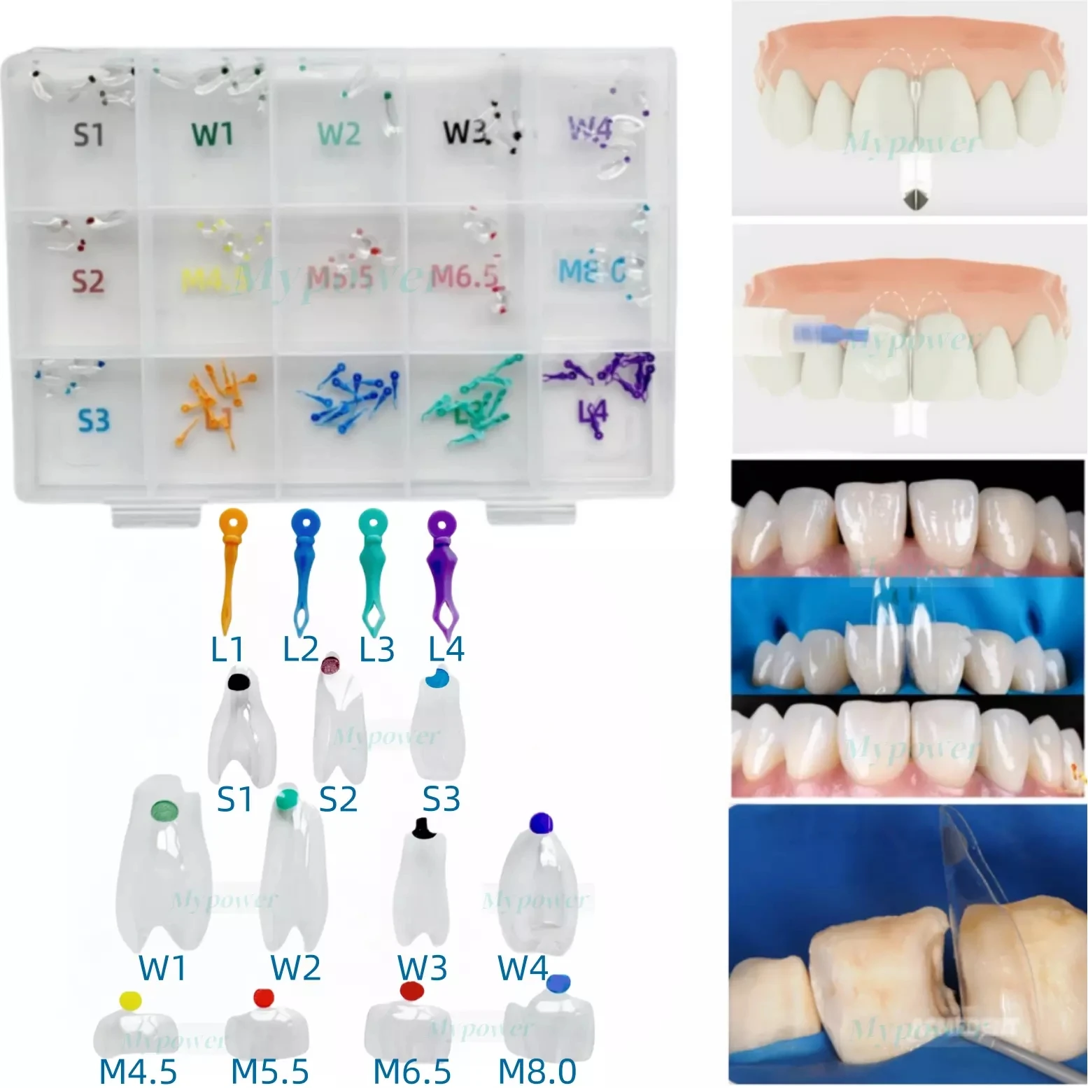 Dental Clear Matrix Diastema Matrices Wedges Similar with BioClear Matrice 150Pcs/Box