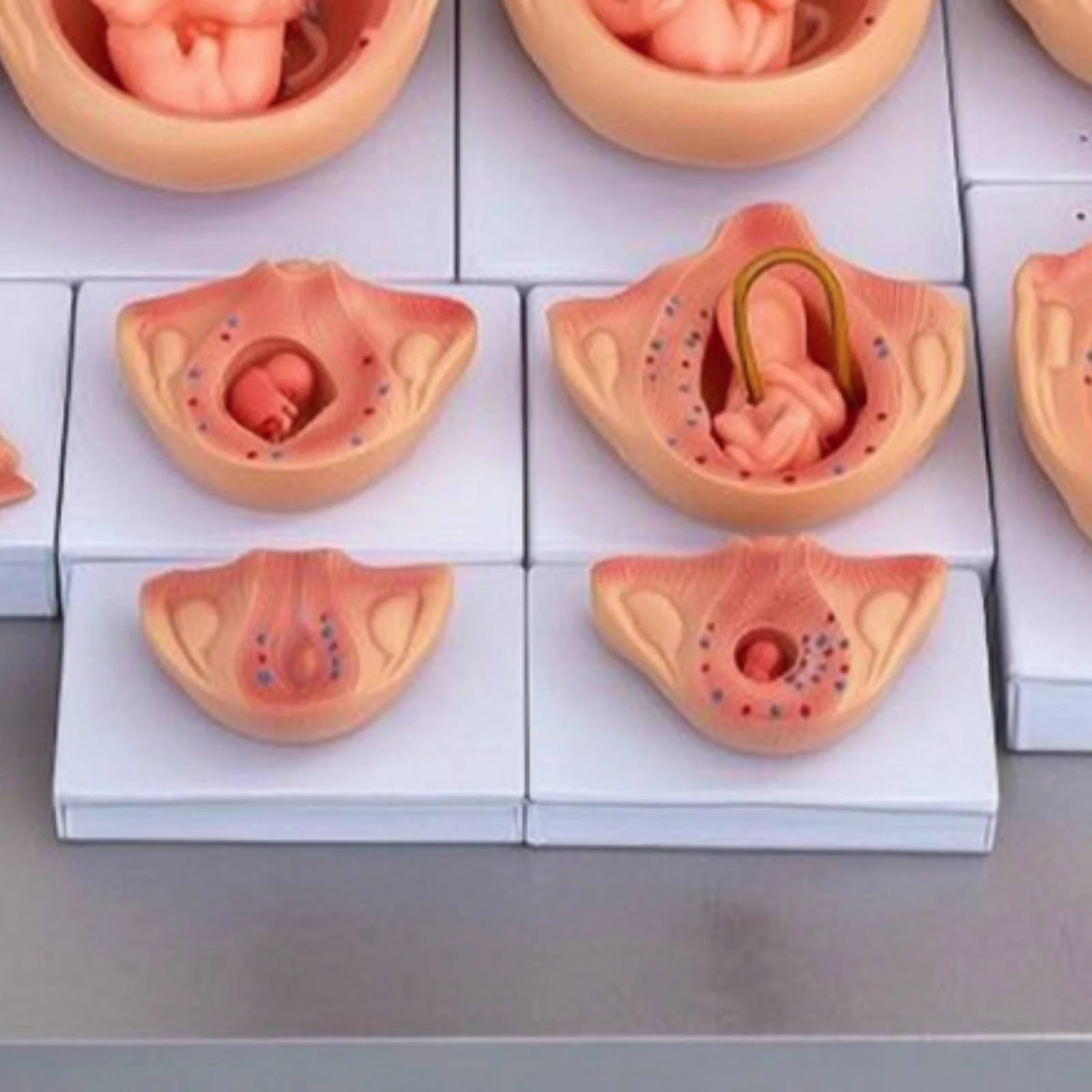 10 Pieces Fetal Development Process Model Detailed Fetal Development Model Medical Accurate for Teachers, Classroom