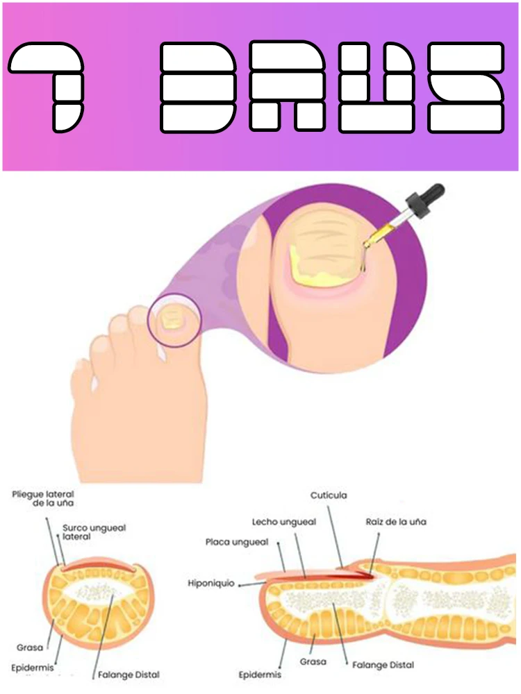 

Quickly eliminate fungus and restore healthy nails