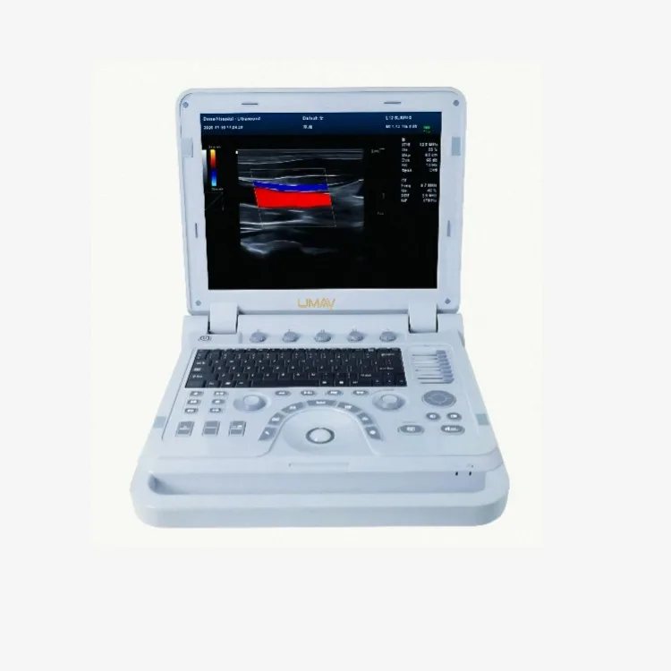 Veterinary Black and White Digital Ultrasound Machine Portable Best Price Diagnostic Ultrasound