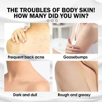 8 best sales جلد الدجاج - №6