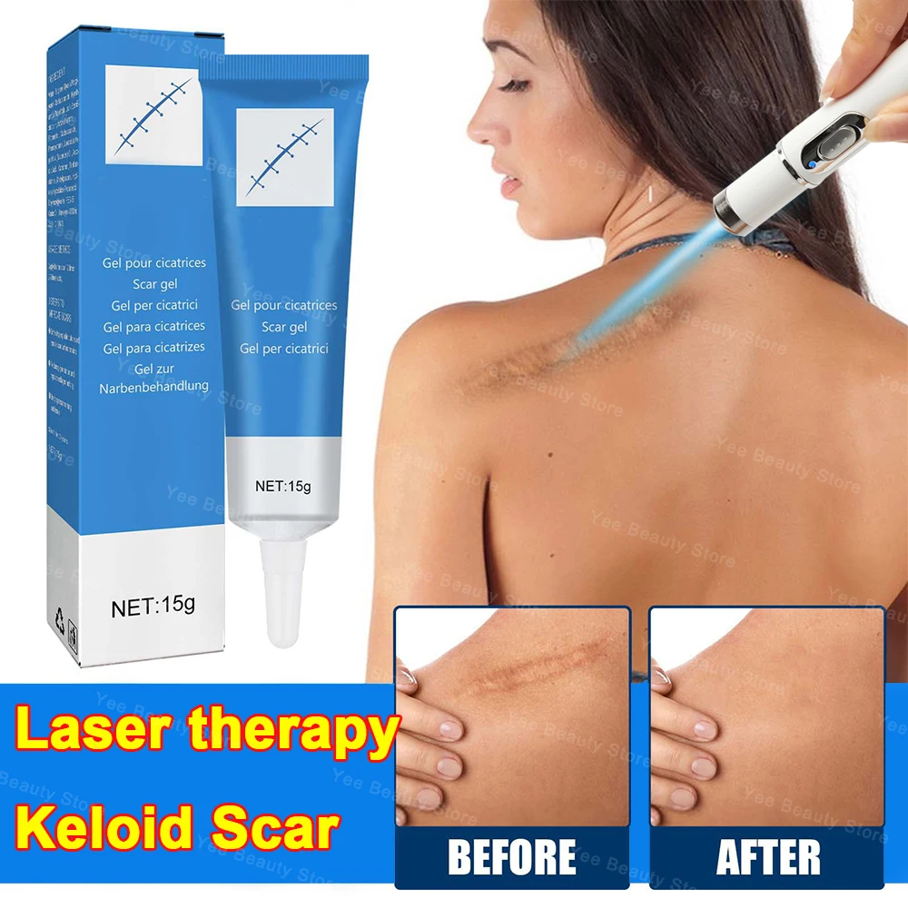 Scar Relief Pen Laser therapy Keloid Scar Easy Harmless Comfortable Improve Keloid Scar Pen Scar Relief Products 2024 New