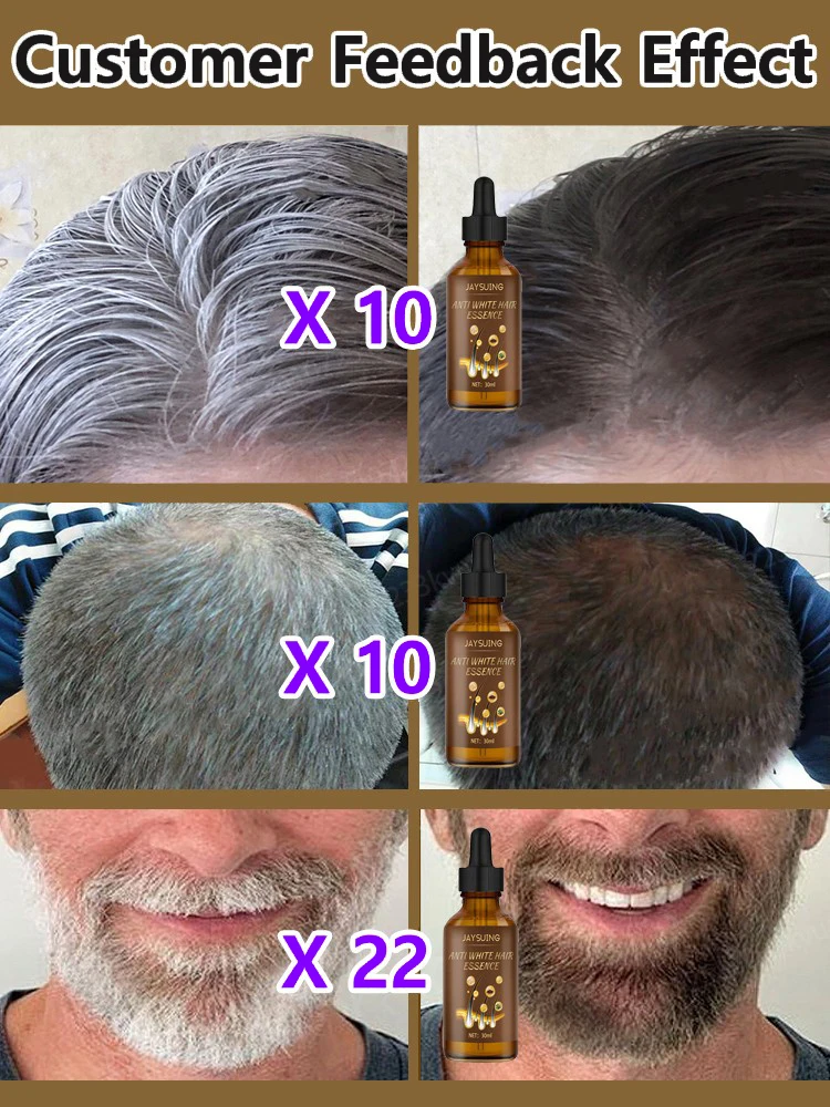 Anti-grey Hair Serum to Restore Gray Beard and Hair Natural Color Oil Cover White To Hair Darken Anti-Hair Loss Nourish HairCare