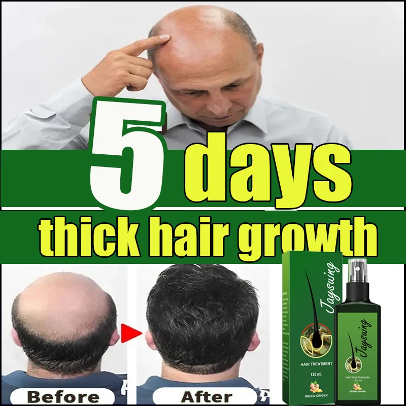 

Природный имбирь для роста волос спрей для корней волос раньше предотвращает выпадение волос лечение облысения густые волосы красота уход за волосами для мужчин женщин