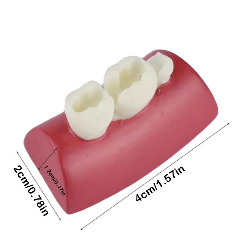 

Oral Filling Model Dental Inlay Exercise Model Block Filling Exercise Typodont Resin Materials For Dentistry Teaching Stud