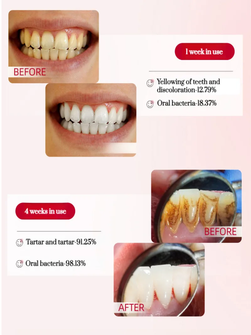 Mild tooth care Toothpaste Oral Care Products Strengthen your teeth Oral health Brush away dental calculus in 3 days