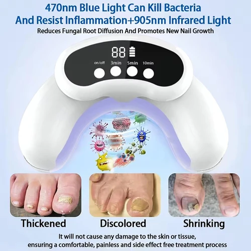 Imagen 2 del producto Dispositivo láser inalámbrico para hongos en las uñas de los pies, luz infrarroja de onicomicosis, 470nm, 910nm, luz azul, equipo láser antifúngico