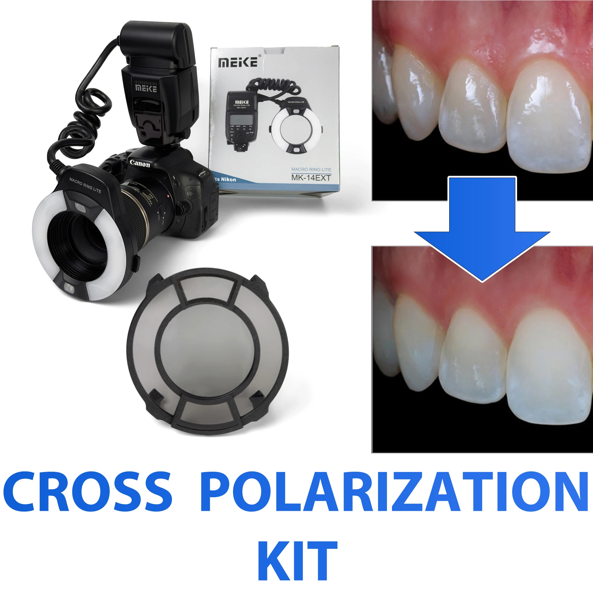 

Cross Polarizing Lens Filter For Dental Photography - No Glare, No Relfection Intraoral Photos For Dentist For MEIKE Flash