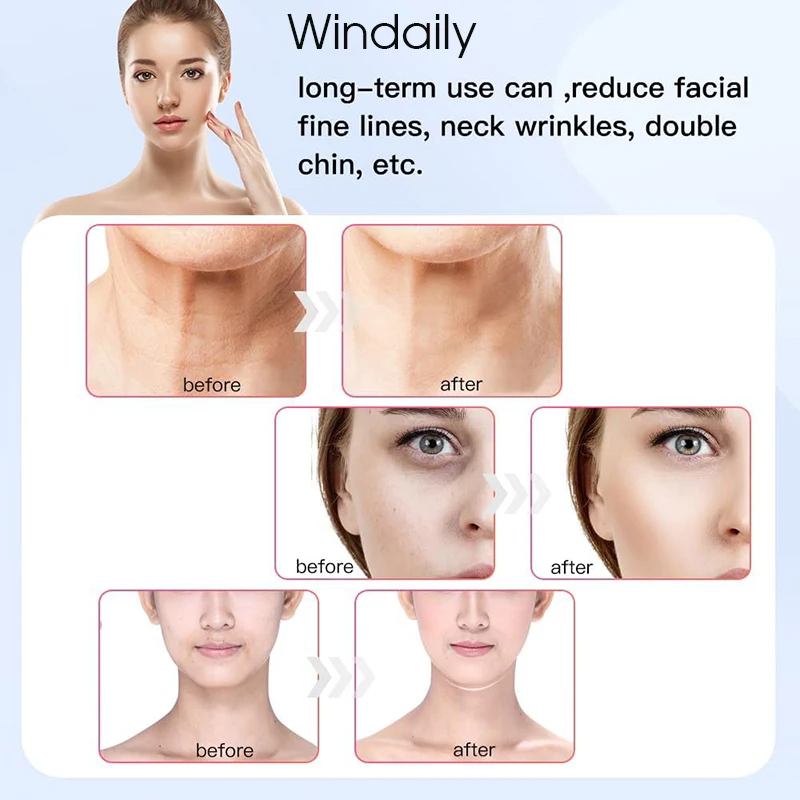 EMS Face คออุปกรณ์ยกการสั่นสะเทือนเครื่องนวดหน้า LED Light Therapy เครื่องกระชับผิวริ้วรอย Remover Skin Care เครื่องมือ