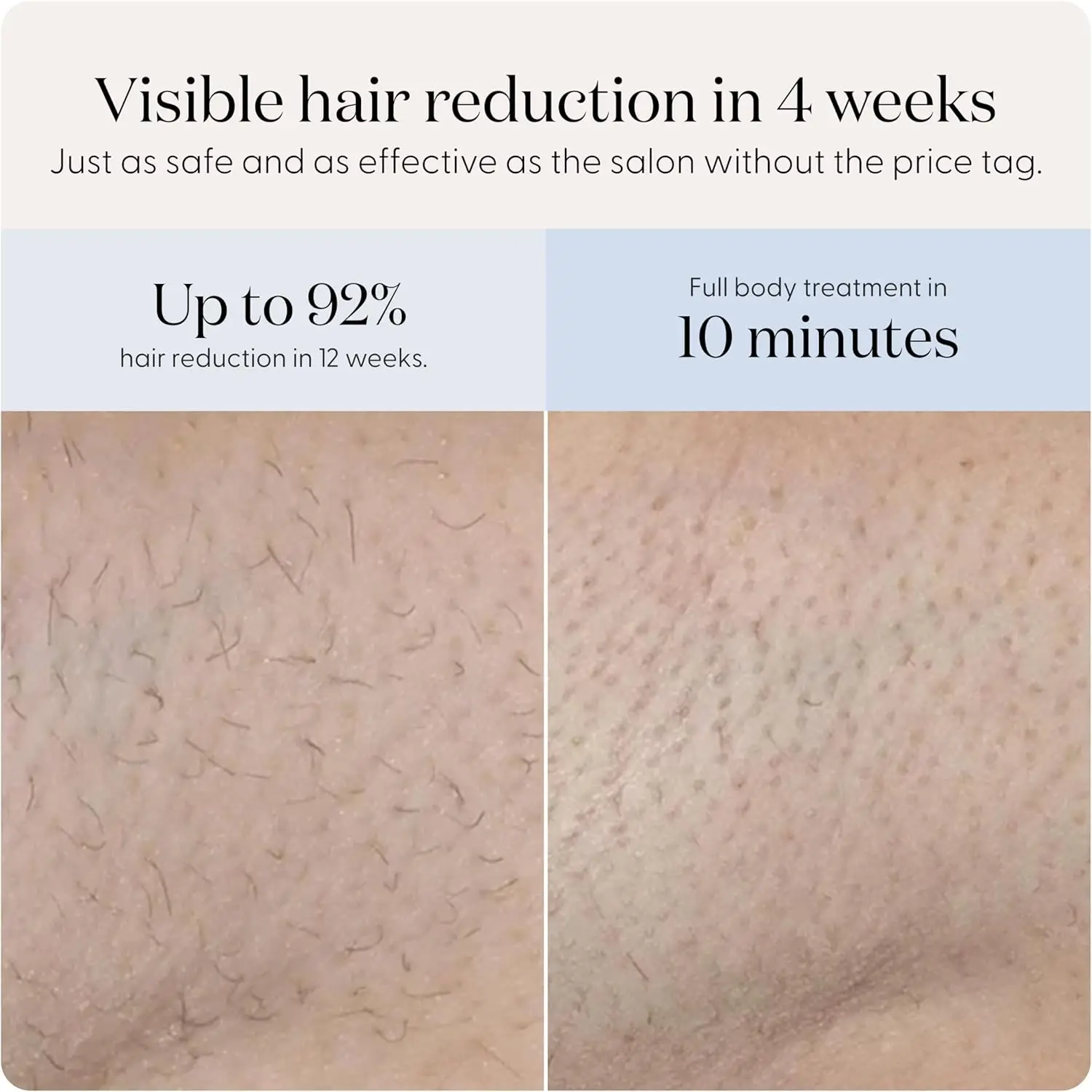 Pure Mini Lite IPL Hair Removal Device – Compact, Safe for Face & Body, Gentle & Painless, Salon-Quality Results