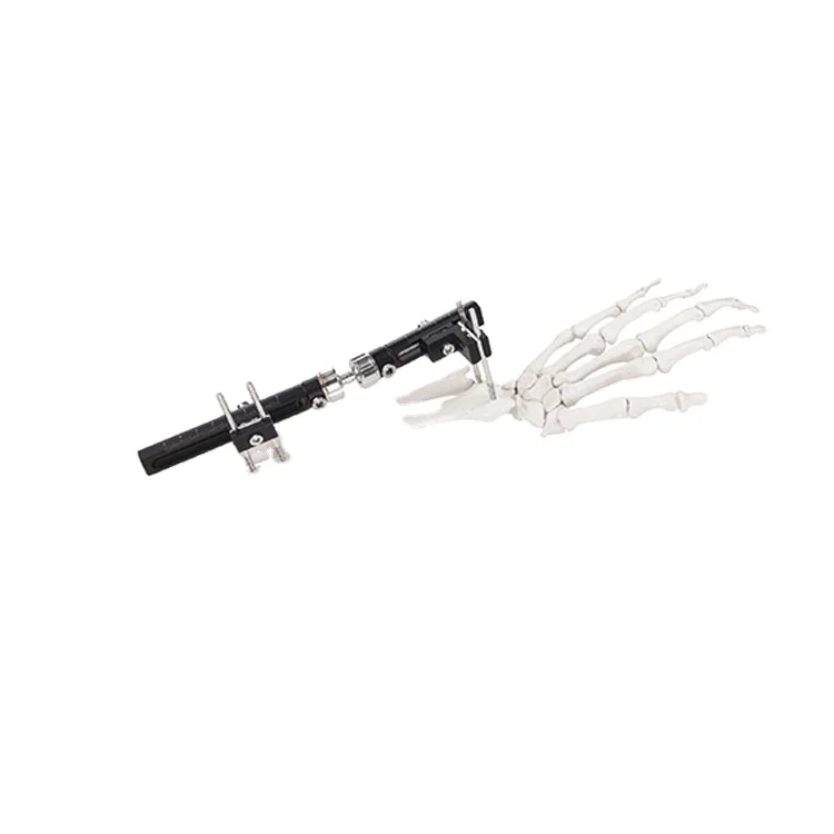 Fracture Surgery Single Side Intergrated External Fixation Single Locking Type Wrist Fixator