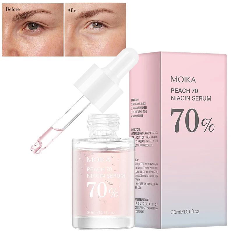 

Сыворотка MOIKA Peach 70 с ниацинамидом 70% (30 мл) для увлажнения, осветления пигментных пятен, следов от акне, гиперпигментации, сужения пор и выравнивания тона кожи.