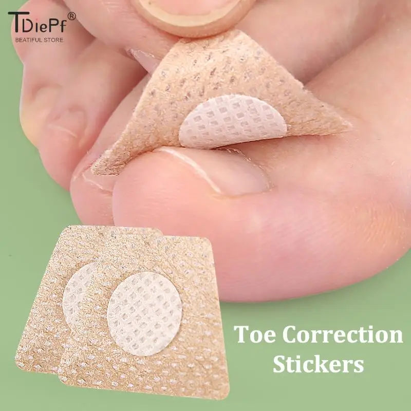 陥入爪足指補正ステッカーネイルアートフットパッチ足ケア爪周囲炎治療回復ペディキュアフットツール
