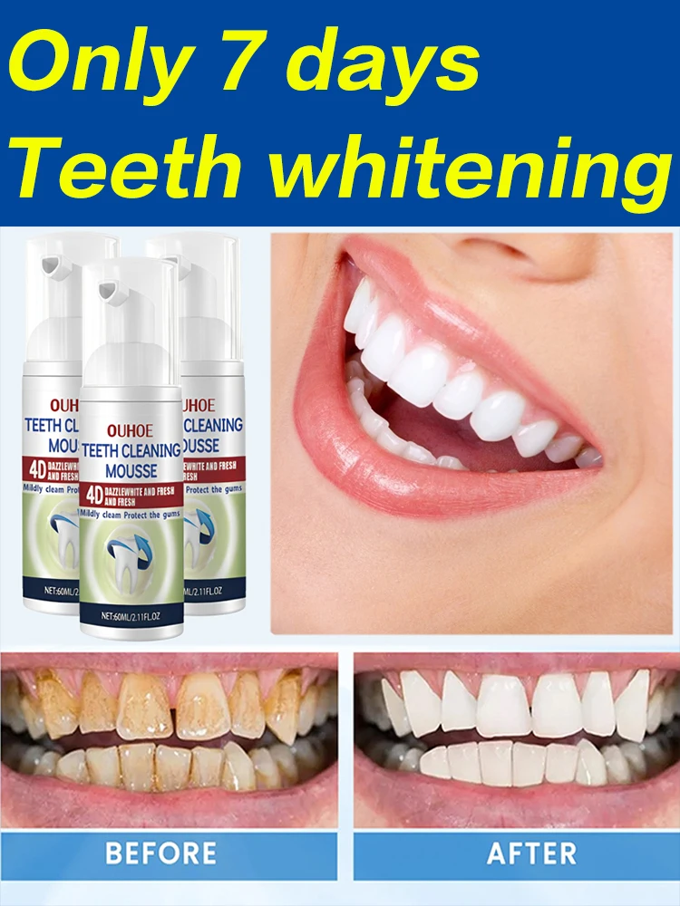 

Whitening Toothpaste Oral Cleaning Fresh Breath Remove Plaque Yellow Teeth Stain Gum